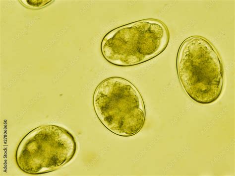 Strongyle Eggs Under The Microscope Uncinariaancylostoma Hookworm