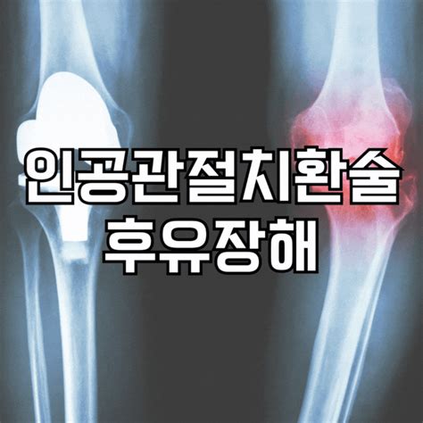 인공관절치환술 후유장해 보상 제대로 받는 법 네이버 블로그