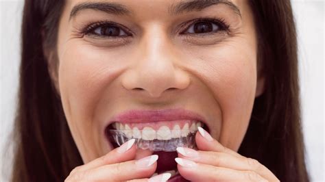 How To Take Care Of Your Invisalign Aligners Nerdynaut