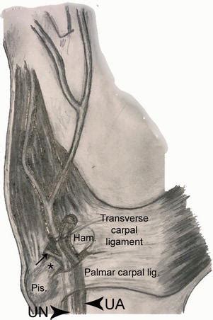 Hypothenar Muscles and Guyon’s Canal | IntechOpen