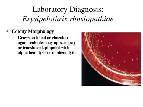 Ppt Coryneform Bacteria Listeria And Erysipelothrix Powerpoint