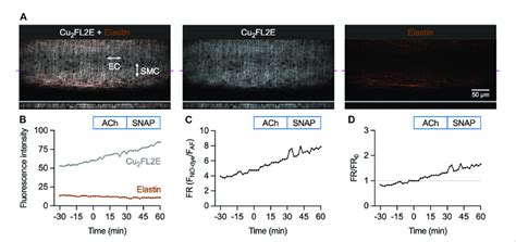 Cu 2 FL2E Response To ACh And SNAP In The Pressurized Artery Setup A