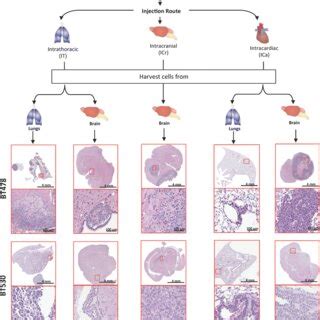 Development of a novel human-mouse xenograft model of lung-to-brain ...