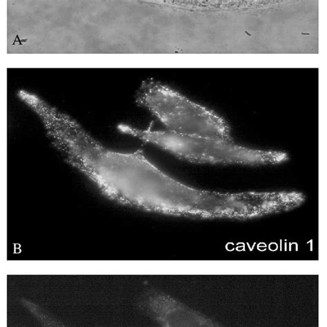 The Effect Of Nm Oa On The Cellular Distribution Of Caveolin And