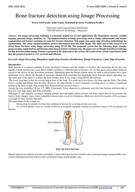 Pdf Bone Fracture Detection Using Image Processing