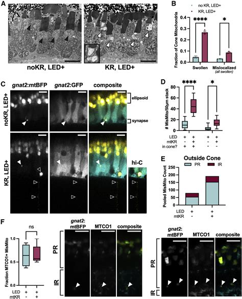 Cone Photoreceptors Transfer Damaged Mitochondria To Müller Glia Cell Reports