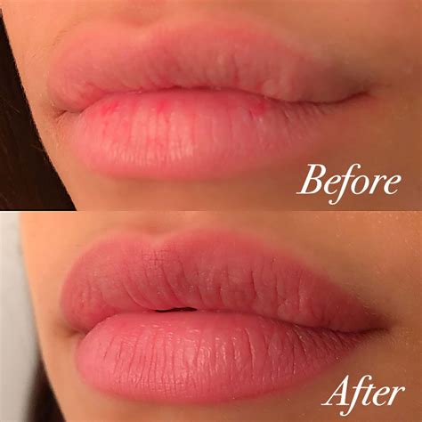 Professional Lip Blushing Services And Contouring Procedure