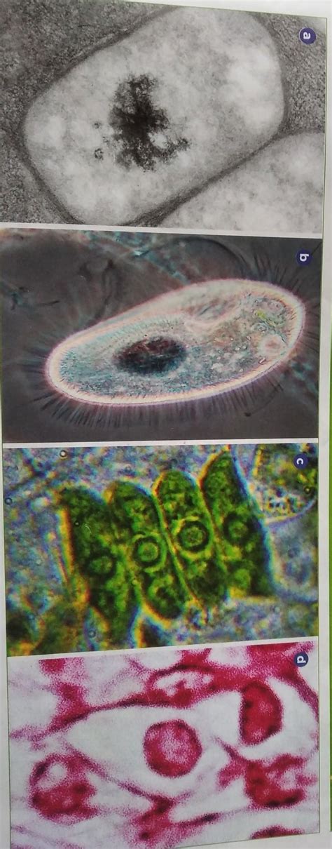 Observa Las Células De Laimagen La Microfotografía A Ha Sido Obtenida Con Un Microscopio