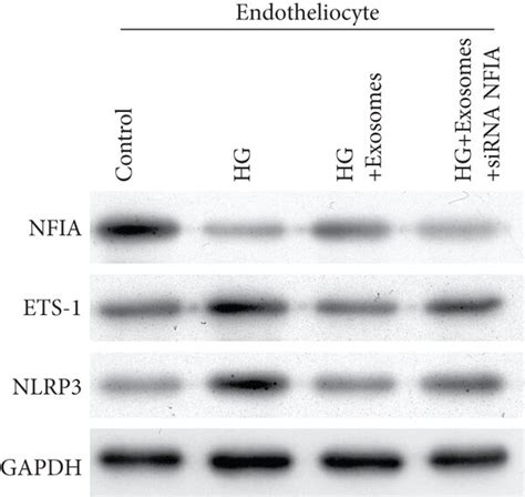 Exosomal CircEhmt1 Protected Endotheliocytes From HG Induced Injury By