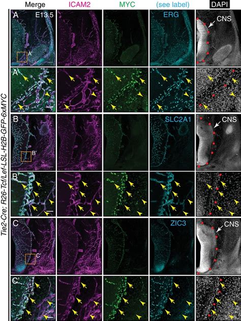 Transcriptional And Epigenomic Landscapes Of Cns And Non Cns Vascular