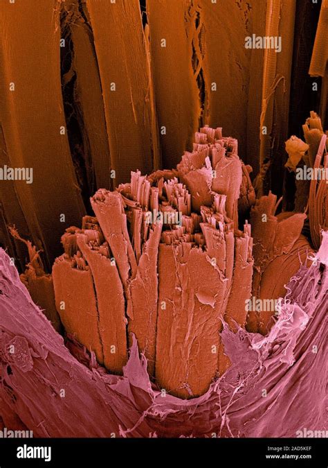 Coloured Scanning Electron Micrograph Sem Frog Skeletal Leg Muscle