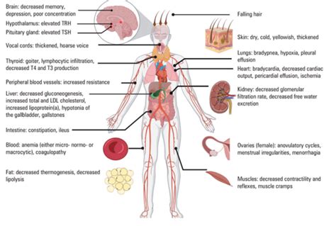 hashimotos thyroiditis symptoms  ibs gut health clinic