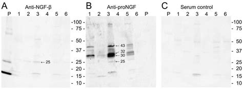 Ijms Free Full Text The Role Of Nerve Growth Factor Ngf And Its