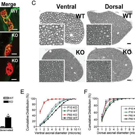 NMJ And Motor Axon Degeneration In MSC P43 Null Mice A NMJs In The