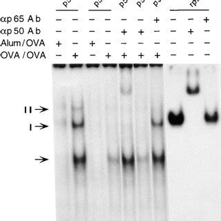 Induction Of Nf B Activity In The Lungs Of P But Not P Mice