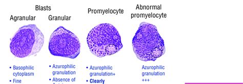 Promyelocyte Lineage