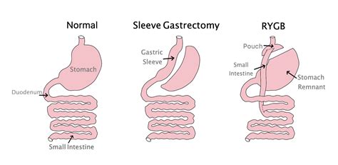 Obesity | Endocrine Conditions