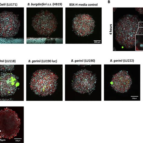 Blood Brain Barrier Organoids Support Entry Of Borrelia Burgdorferi A