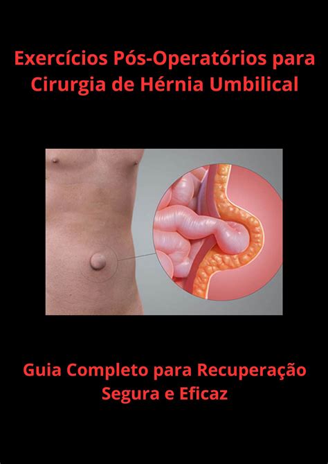 Dicas e cuidados no pós operatório de hérnia umbilical kleber mathias