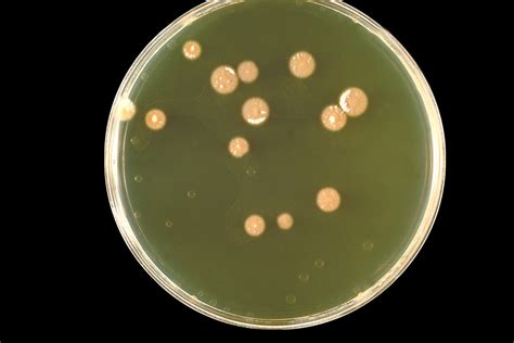 Public Domain Picture Pictured Is A Sabhi Agar Plate Culture Of The