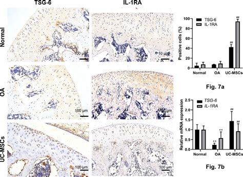 Intra Articular Injection Of Human Umbilical Cord Mesenchymal Stem