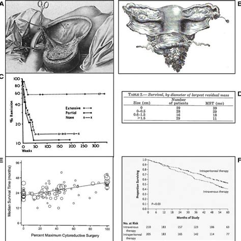 Six years of cytoreductive surgery workshops | Download Table