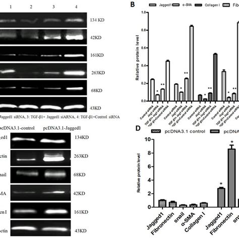 A Knockdown Of Jagged1 Inhibited The Activation Of Hscs And Suppressed