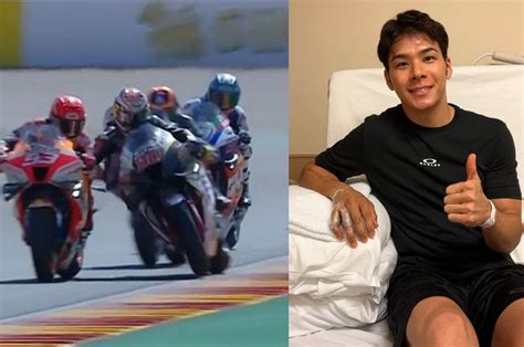 Tersikut Marc Marquez Takaaki Nakagami Kembali Absen Di Jadwal MotoGP