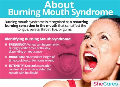 Dry Mouth Burning Tongue Symptoms - Infoupdate.org