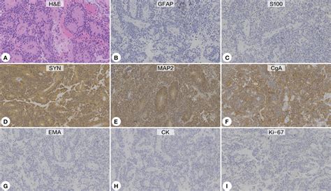 Histopathological And Immunohistochemical Examinations A