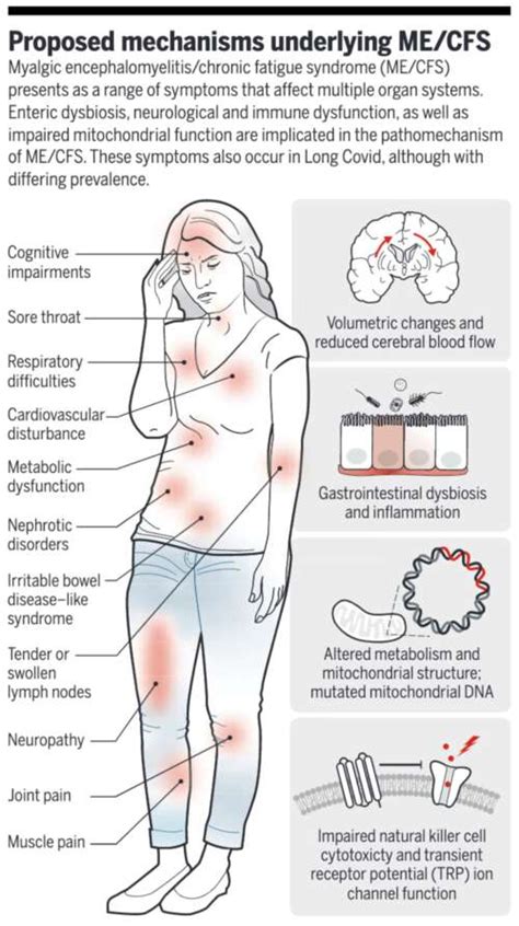 Understanding Chronic Fatigue Syndrome Myalgic Encephalomyelitis