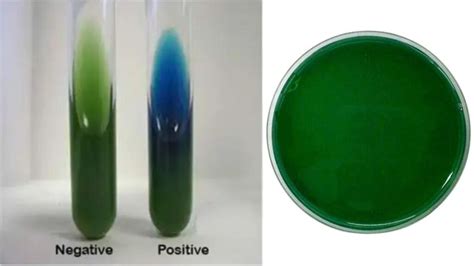 Simmons Citrate Agar - Composition, Principle, Preparation, Results ...