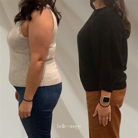Personalized Reset Medical Weight Loss in Burleson, TX