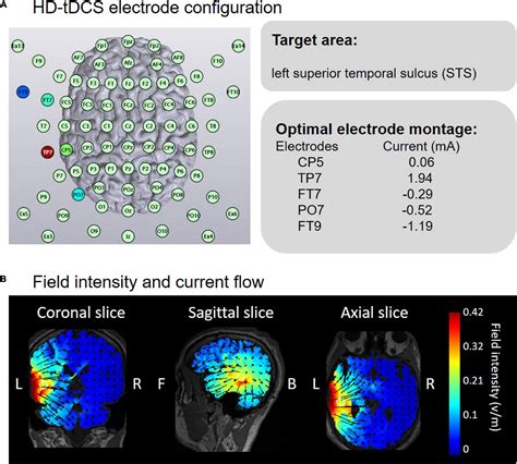 Frontiers Effects Of High Definition Transcranial Direct Current