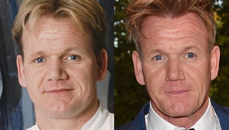 Gordon Ramsay Good Genes Or Good Docs