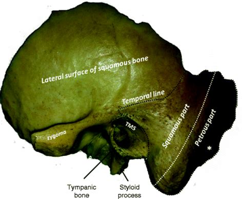 The Mastoid | Ento Key