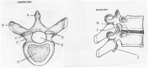 Typical Vertebra Superior Lateral View Diagram Quizlet