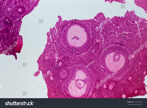 cross section human ovary  microscope stock photo
