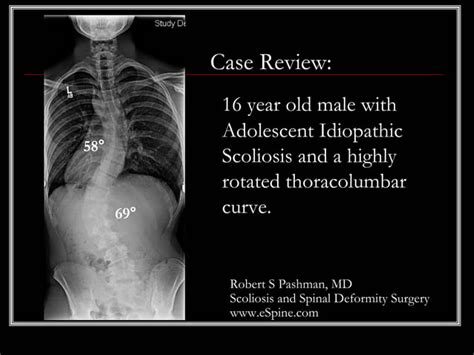 Case Review 16 16 Year Old Male With Highly Rotated Adolescent