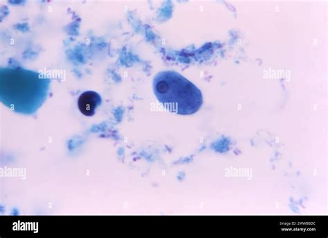 This Photomicrograph Of A Trichrome Stained Specimen Depicted A Parasitic Trophozoite Entamoeba