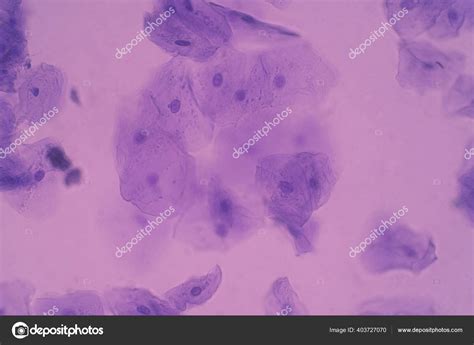 Cheek Epithelial Cells Bacteria