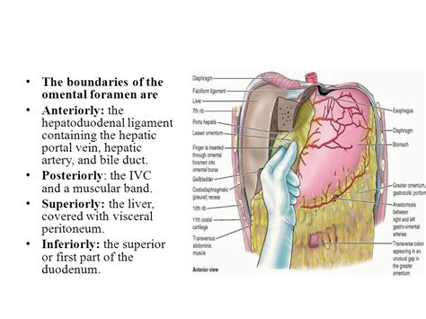 Omental Foramen Boundaries