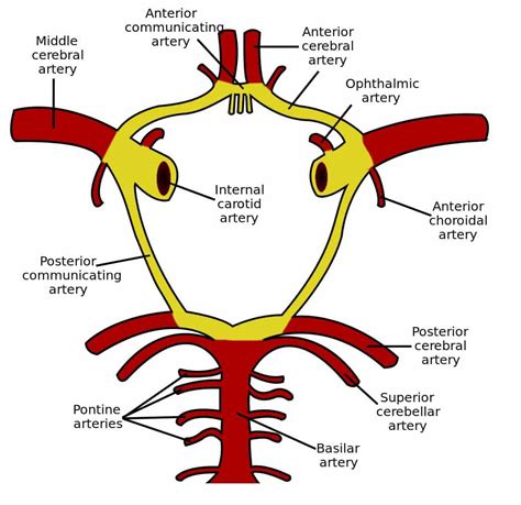 Intracranial Aneurysms TeachMeSurgery