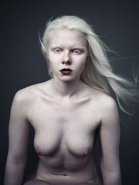 Albino Girl Nude DATAWAV