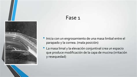 Pinguecula Y Pterigion Ppt