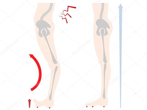 Ilustraci N De La Parte Inferior Del Cuerpo Y Distorsi N Sea De Los