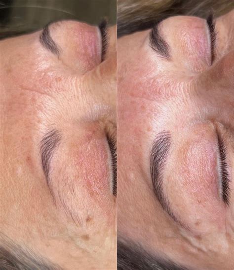 Jessica Microblading Artist On Instagram Transformation Monday My