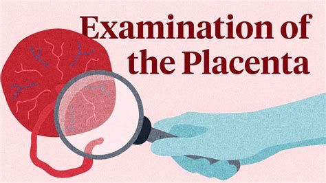 Examination Of The Placenta Ausmed