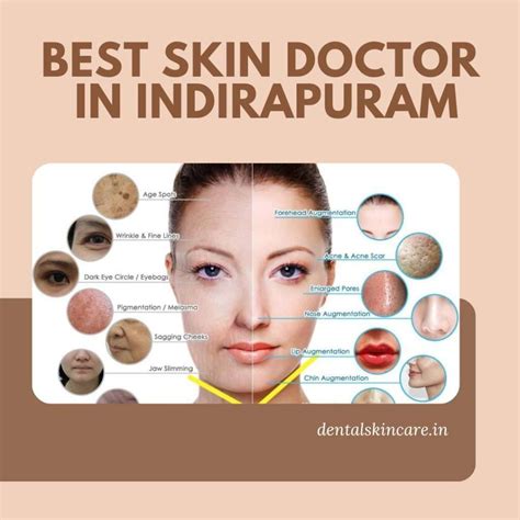 Best Skin Doctor In Indirapuram Delhi Portal