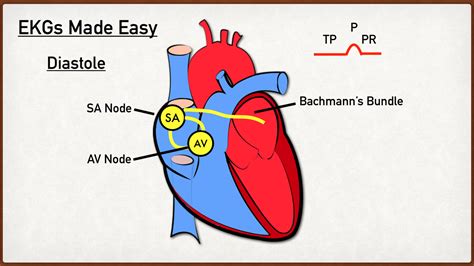 EKG or ECG Waveform Parts Easily Explained and Labeled — EZmed ...